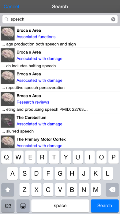 3D Brain screenshot 1