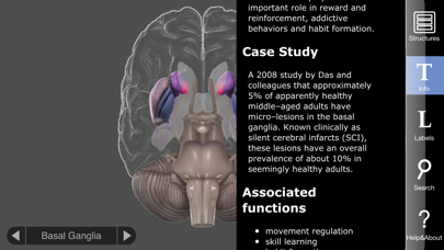 3D Brain screenshot 3