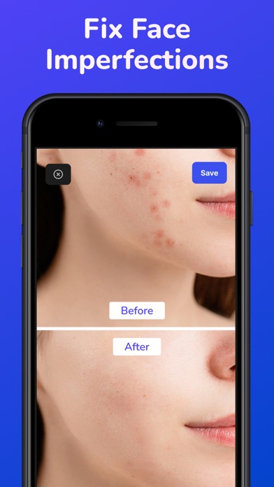 AI Eraser - Object Remover screenshot 3
