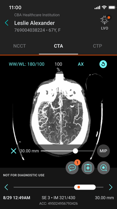 Aidoc screenshot 3