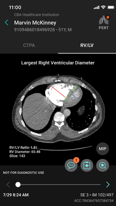 Aidoc screenshot 1