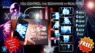 Amazing X-Ray FX ² LITE screenshot 4