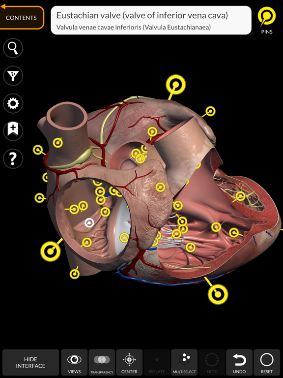 Anatomy 3D Atlas screenshot 9