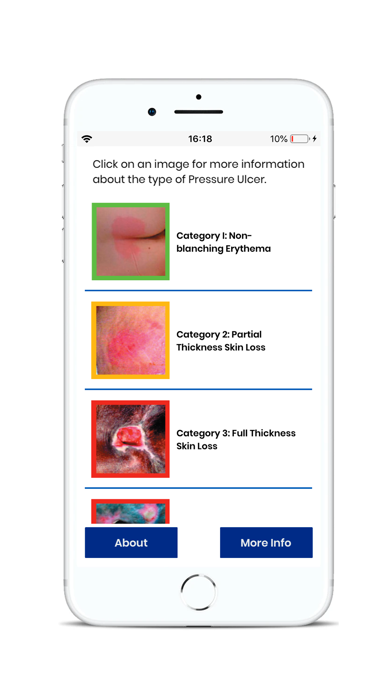 BCG Pressure Ulcer Guide screenshot 4