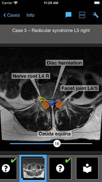 BerlinCaseViewer: Imaging screenshot 3