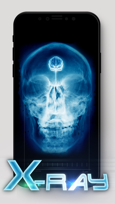 Best X-Ray screenshot 1
