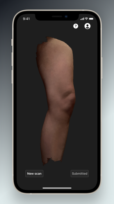 BISHOP 3D Orthotics screenshot 2