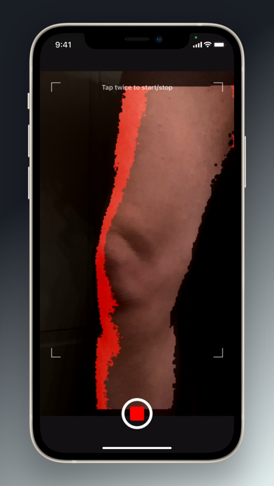 BISHOP 3D Orthotics screenshot 3