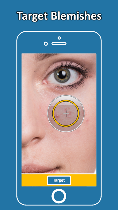 Blemish Remover Photo Tool screenshot 3