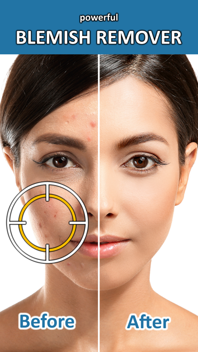 Blemish Remover Photo Tool screenshot 4