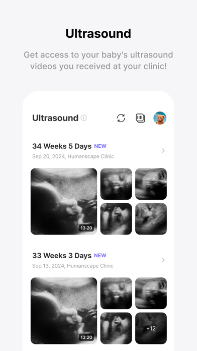 Bomee (Momitalk): Pregnancy screenshot 4