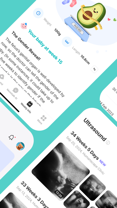 Bomee (Momitalk): Pregnancy screenshot 7