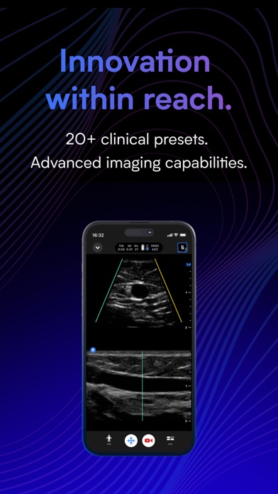 Butterfly iQ — Ultrasound screenshot 3