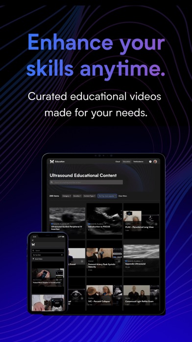 Butterfly iQ — Ultrasound screenshot 1