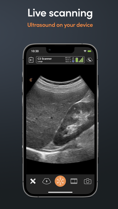 Clarius Ultrasound App screenshot 4