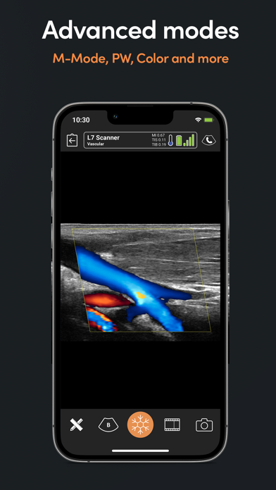 Clarius Ultrasound App screenshot 2
