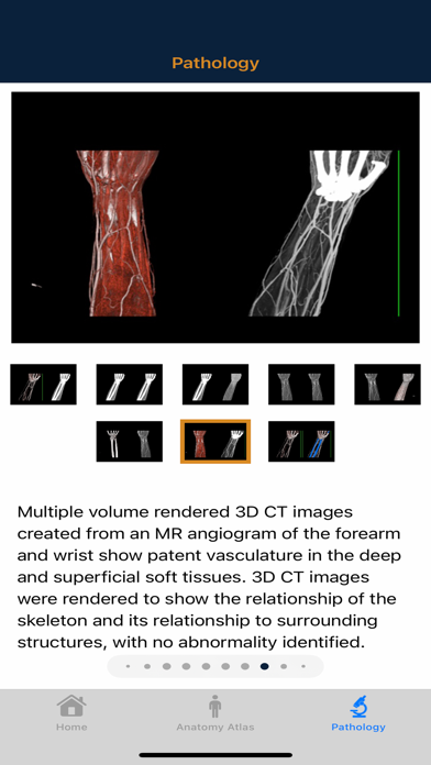 CTisus: CT of the Hand & Wrist screenshot 1