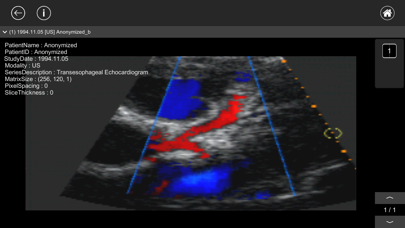 DICOM Viewer : eMma screenshot 2
