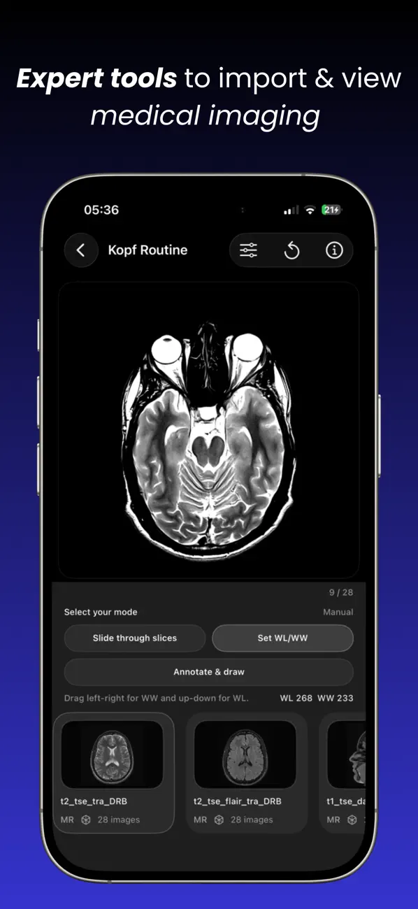 DICOM Viewer : MRI CT XRAY & + screenshot 6