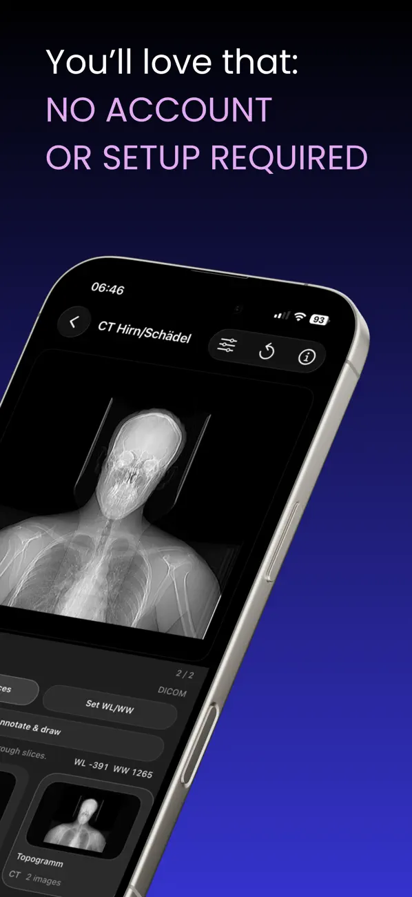 DICOM Viewer : MRI CT XRAY & + screenshot 2