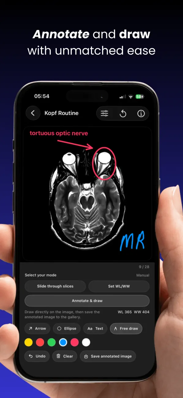 DICOM Viewer : MRI CT XRAY & + screenshot 5