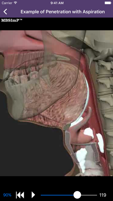 Dysphagia screenshot 4