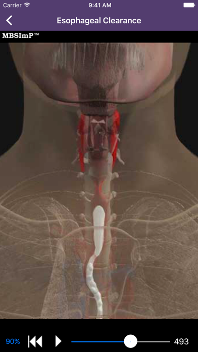 Dysphagia screenshot 1