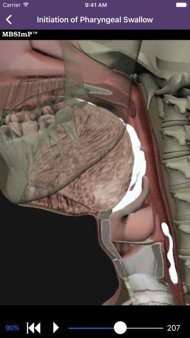 Dysphagia screenshot 3