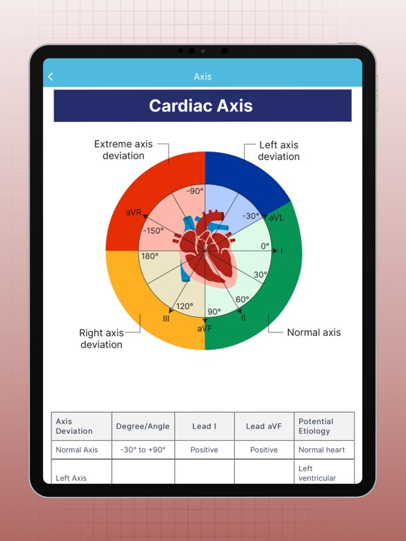 ECG EKG Interpretation Mastery screenshot 3