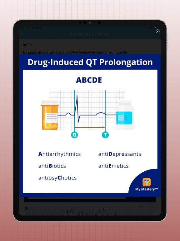 ECG EKG Interpretation Mastery screenshot 4