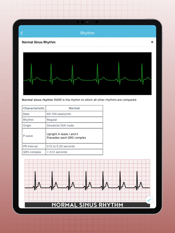 ECG EKG Interpretation Mastery screenshot 1