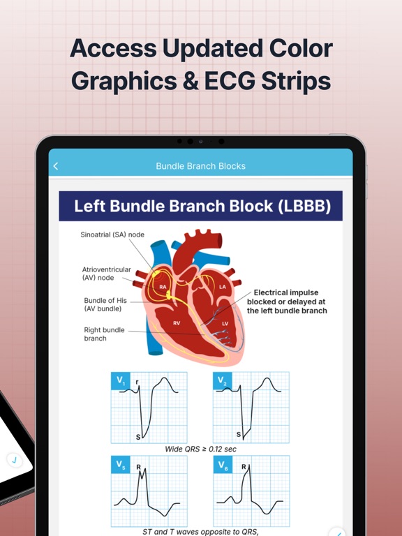 ECG EKG Interpretation Mastery screenshot 9