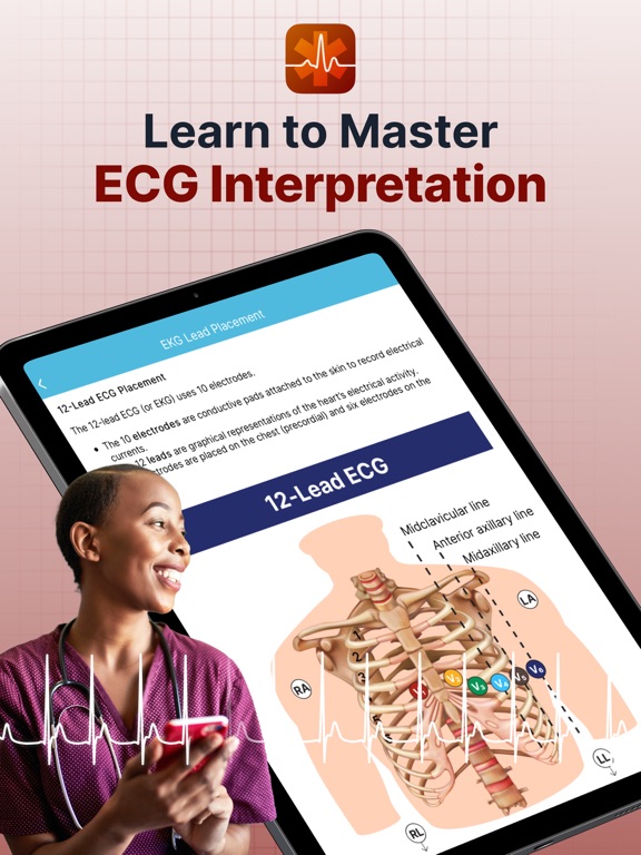 ECG EKG Interpretation Mastery screenshot 10