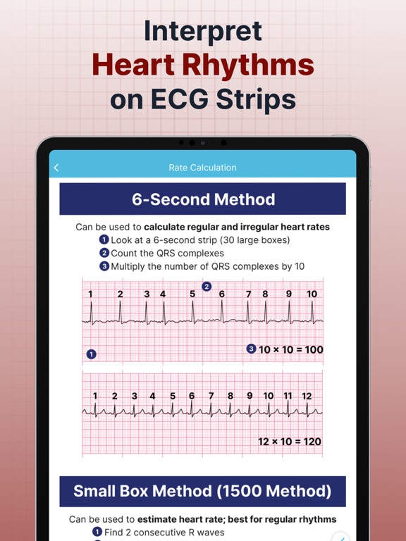 ECG EKG Interpretation Mastery screenshot 7