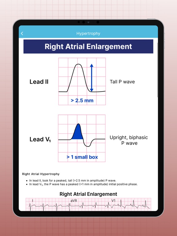 ECG EKG Interpretation Mastery screenshot 2