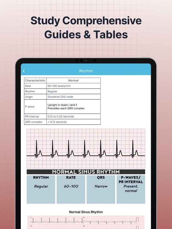ECG EKG Interpretation Mastery screenshot 8