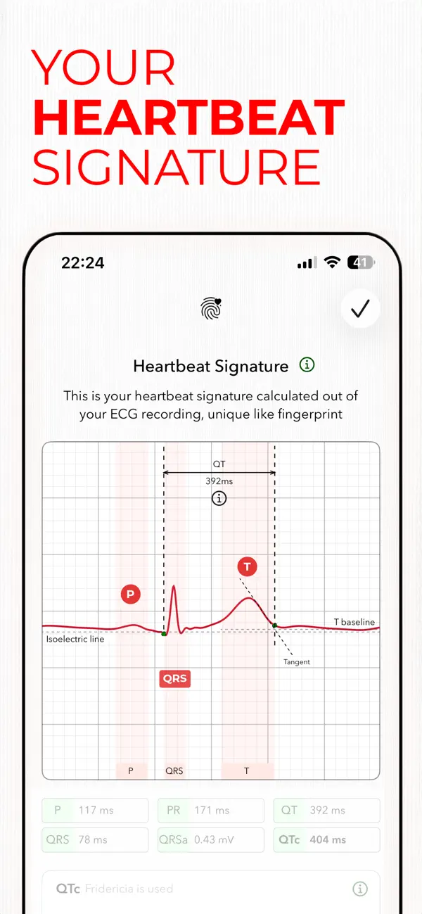 ECG+ | Your Watch ECG Reader screenshot 1