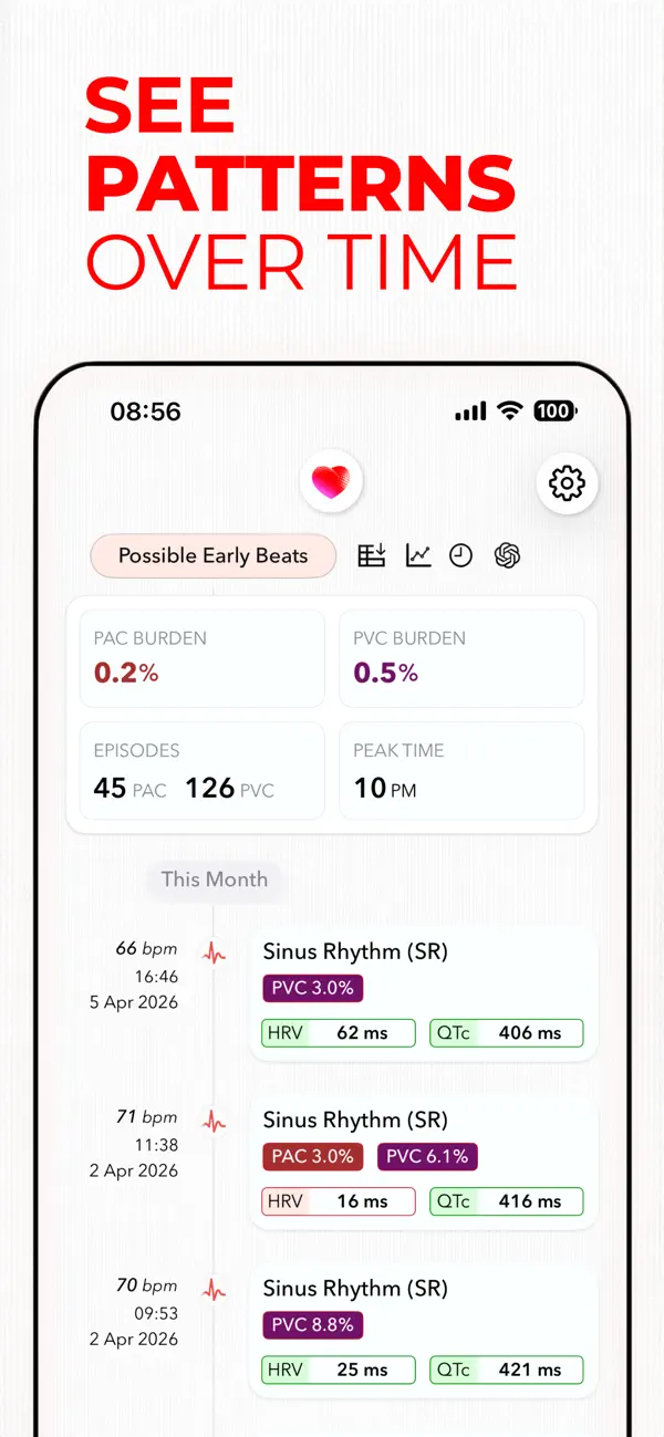 ECG+ | Your Watch ECG Reader screenshot 4