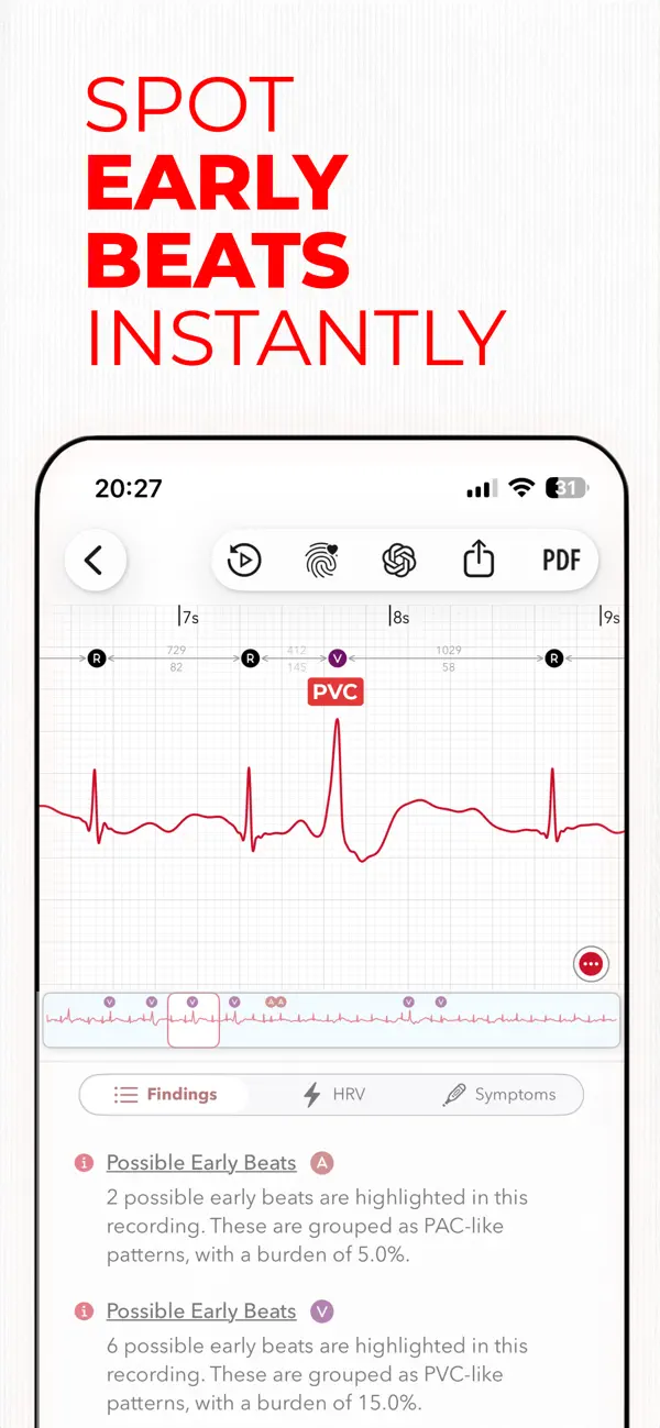 ECG+ | Your Watch ECG Reader screenshot 5