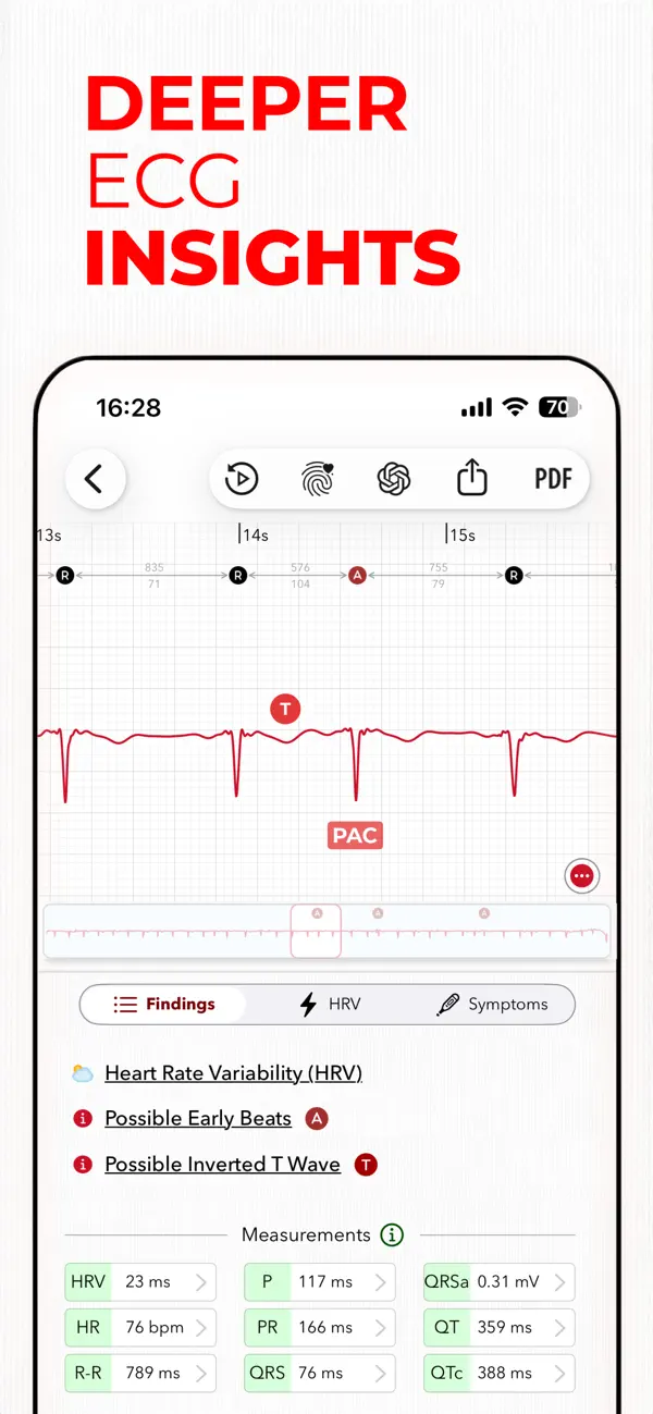 ECG+ | Your Watch ECG Reader screenshot 2