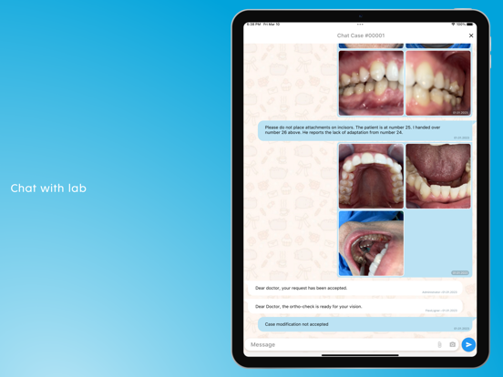 FlexiLigner screenshot 1