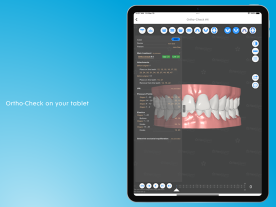 FlexiLigner screenshot 5