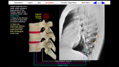 Human Skeleton: Gross Anatomy screenshot 8