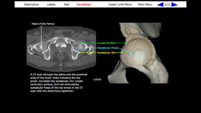 Human Skeleton: Gross Anatomy screenshot 1