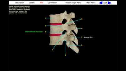 Human Skeleton: Gross Anatomy screenshot 7