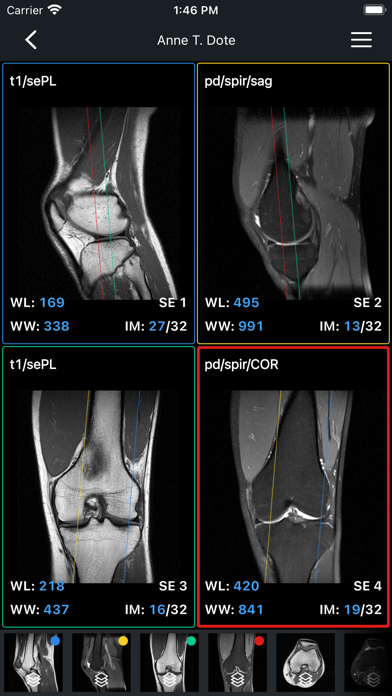 IDV - IMAIOS DICOM Viewer screenshot 3