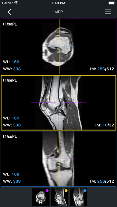 IDV - IMAIOS DICOM Viewer screenshot 1
