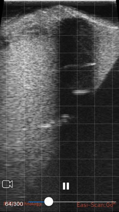 IMV Go Scan screenshot 2