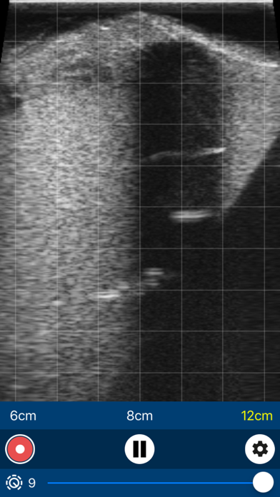 IMV Go Scan screenshot 5