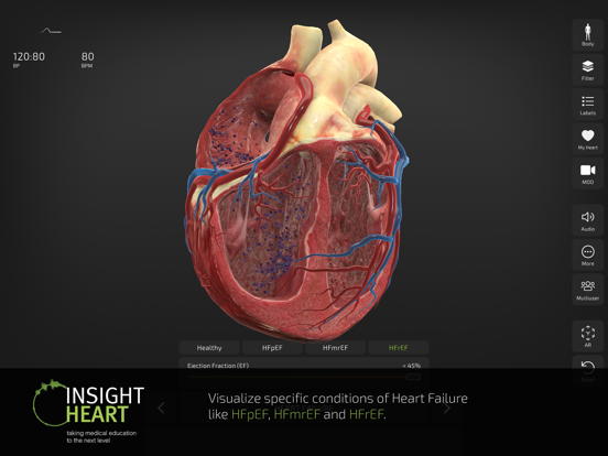 INSIGHT HEART screenshot 6